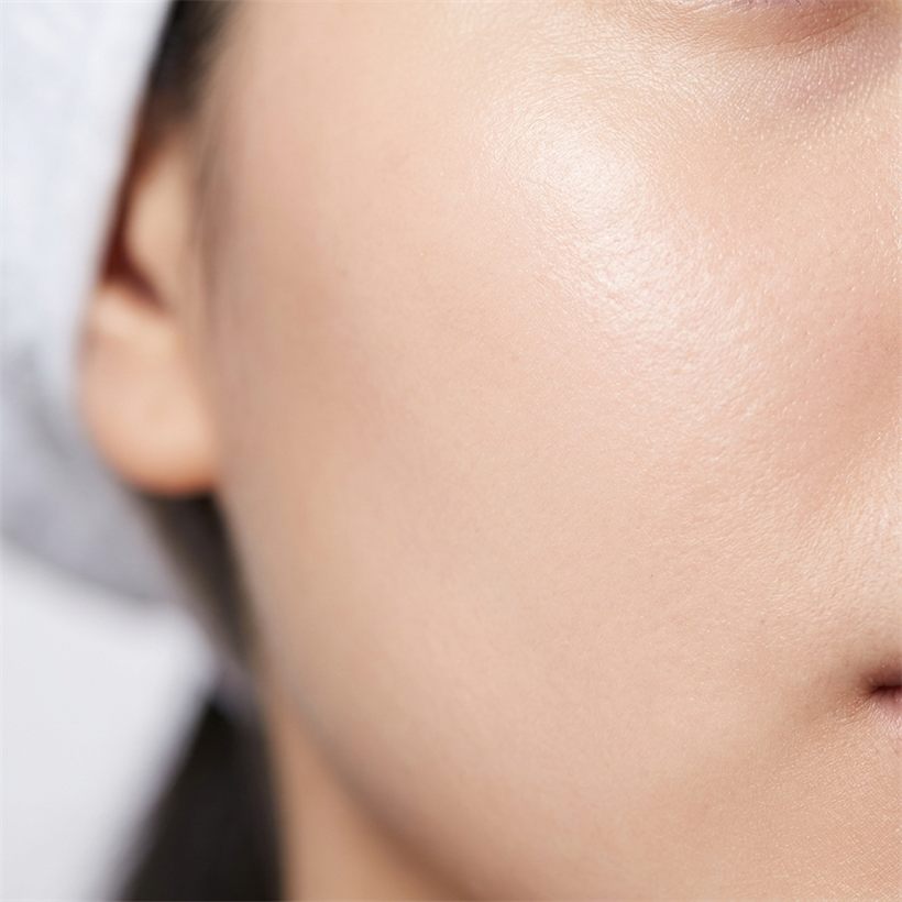Close-up of improved skin texture